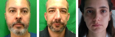 bf_color_preprocessed.jpg bf_color_preprocessed.jpg